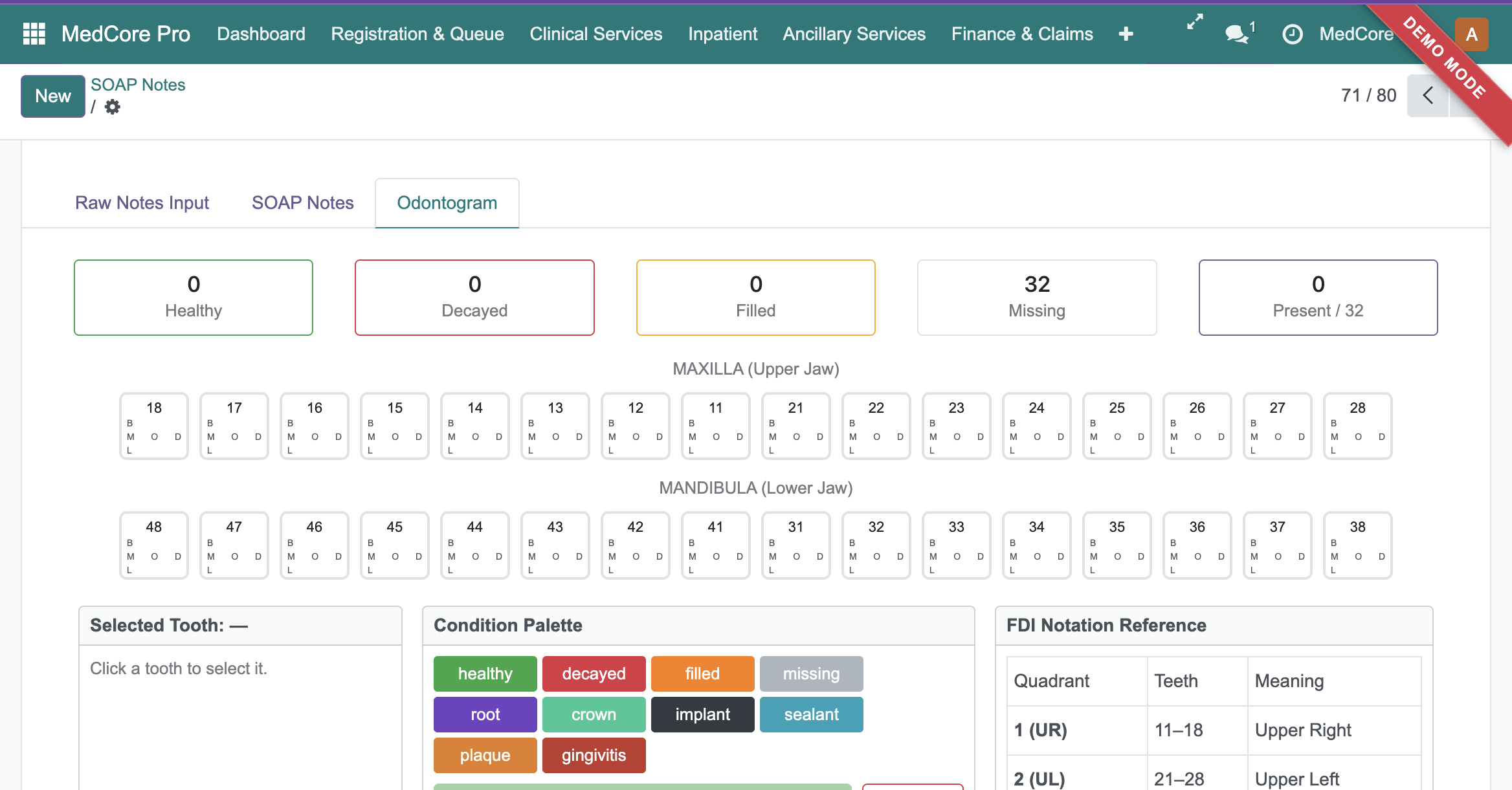 Medcore Pro &mdash; Odontogram